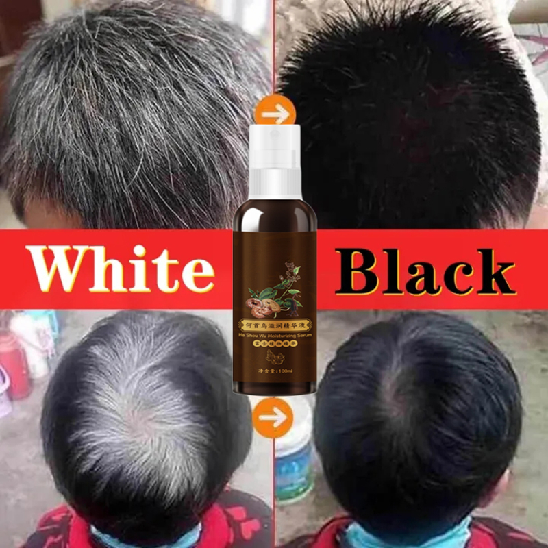 100ml Polygonum Multiflorum Na - Hair Spray Color review and price